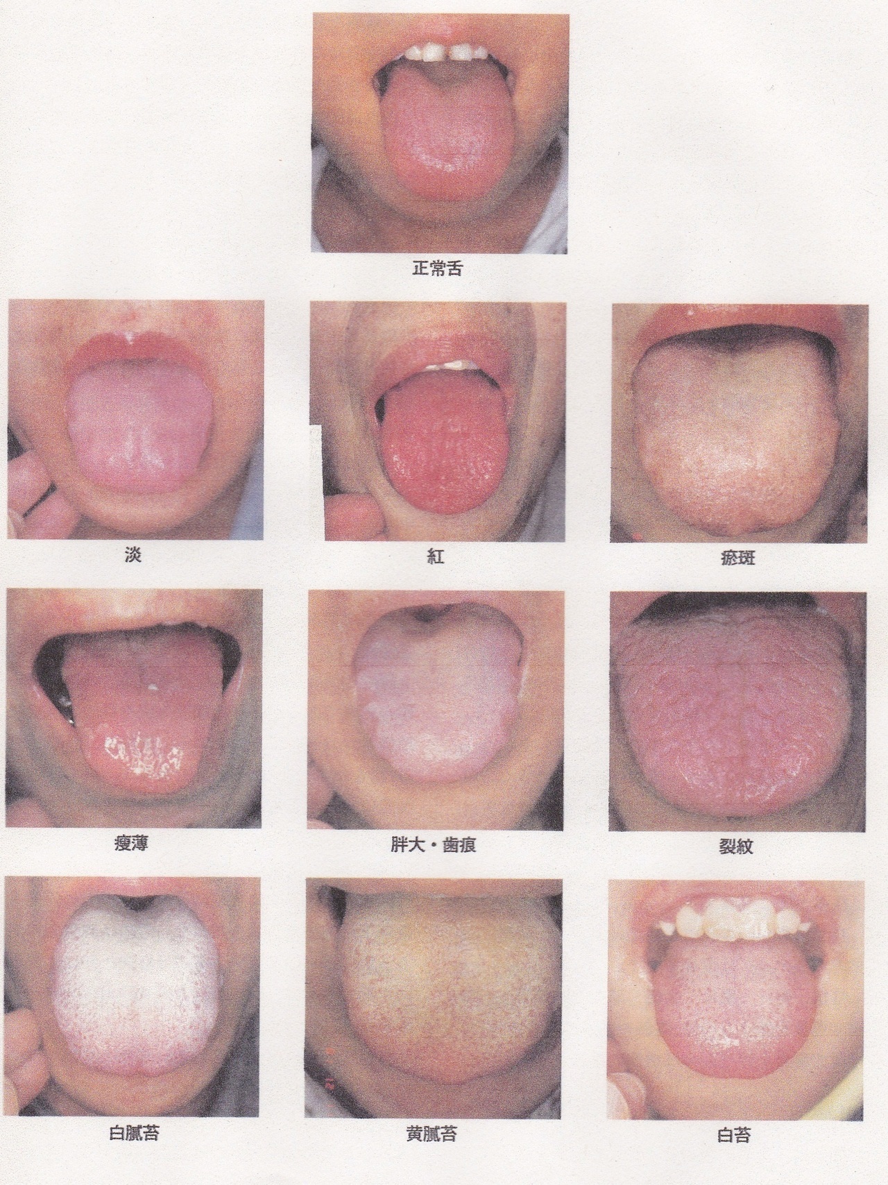 舌診の図